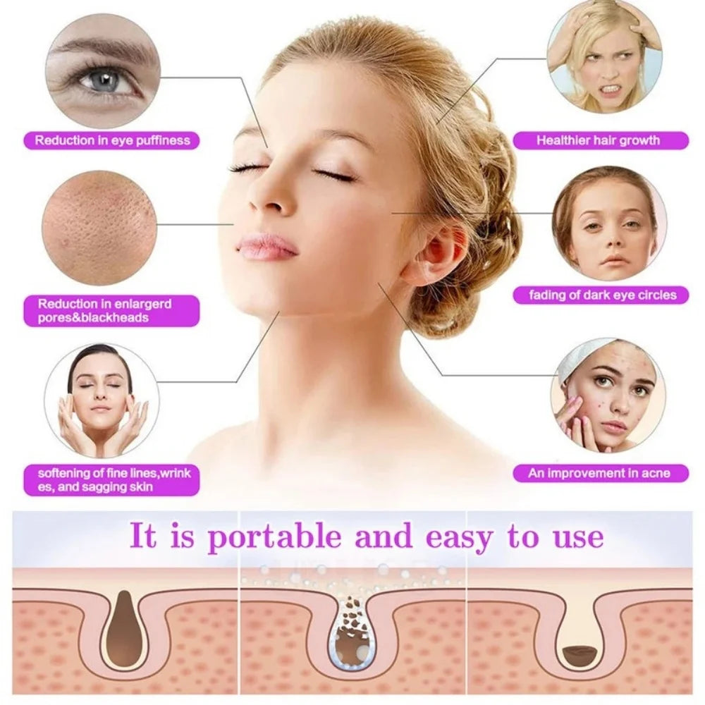 NeyroZen™ High-Frequency Skin & Hair Therapy Wand – 4-in-1 Anti-Aging, Acne & Hair Regrowth Solution